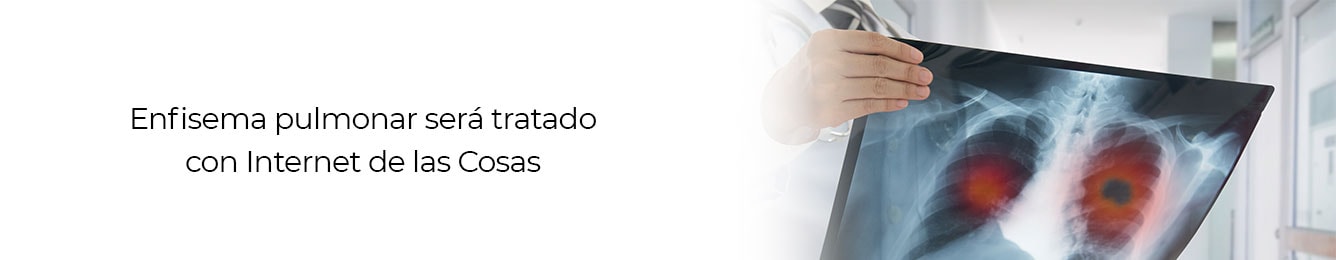 averigua la forma en que el iot podra tratar el enfisema pulmonar
